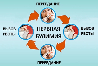 Лечение булимии в Малмыже
